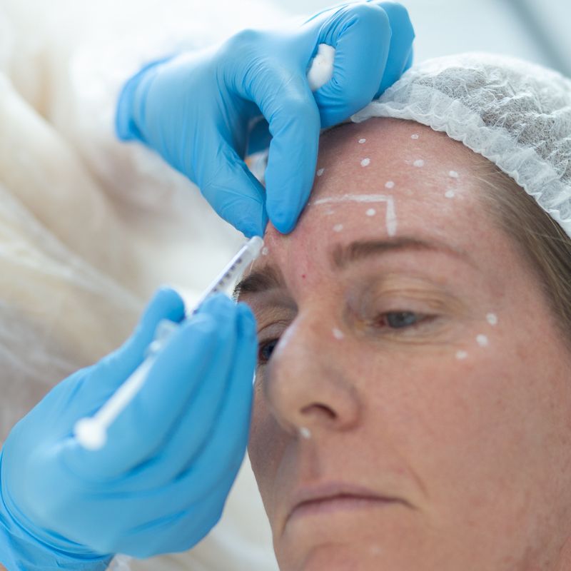 Botox em Campinas Botox em Campinas